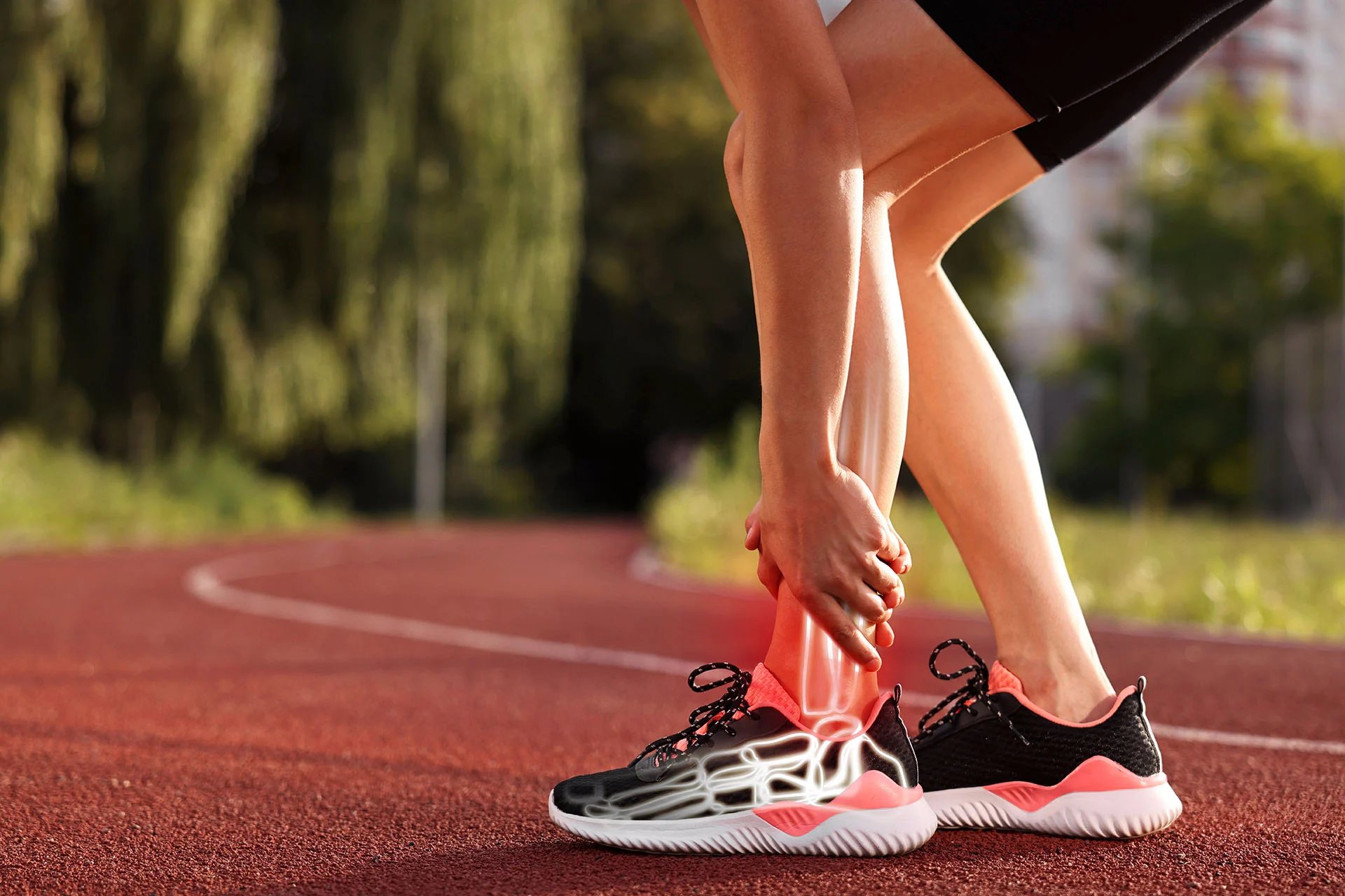 Achilles Tendinopathy in Court Sport Athletes – Featured Image